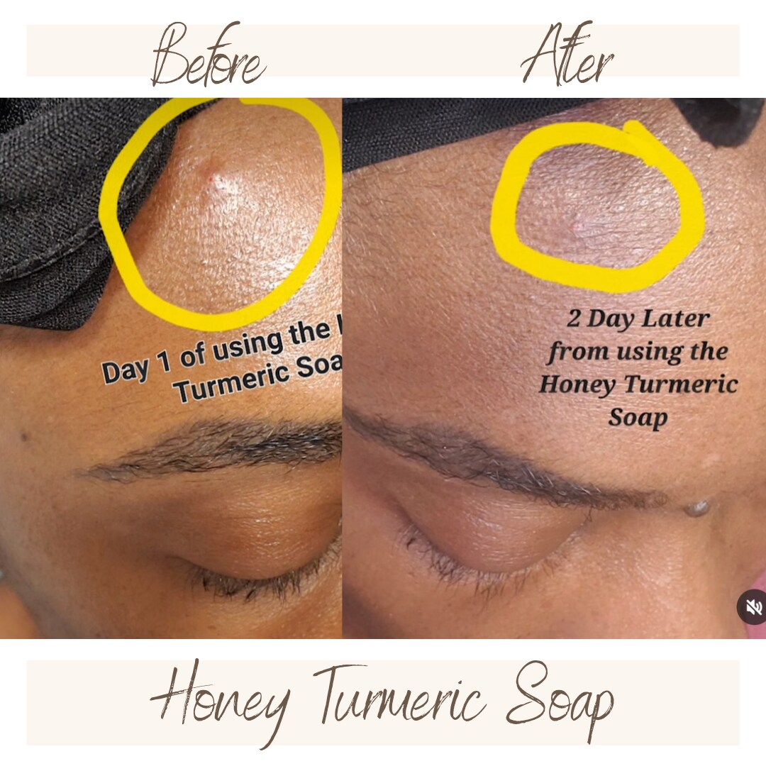 Honey Turmeric Soap, size: S scent:  Fragrance Free