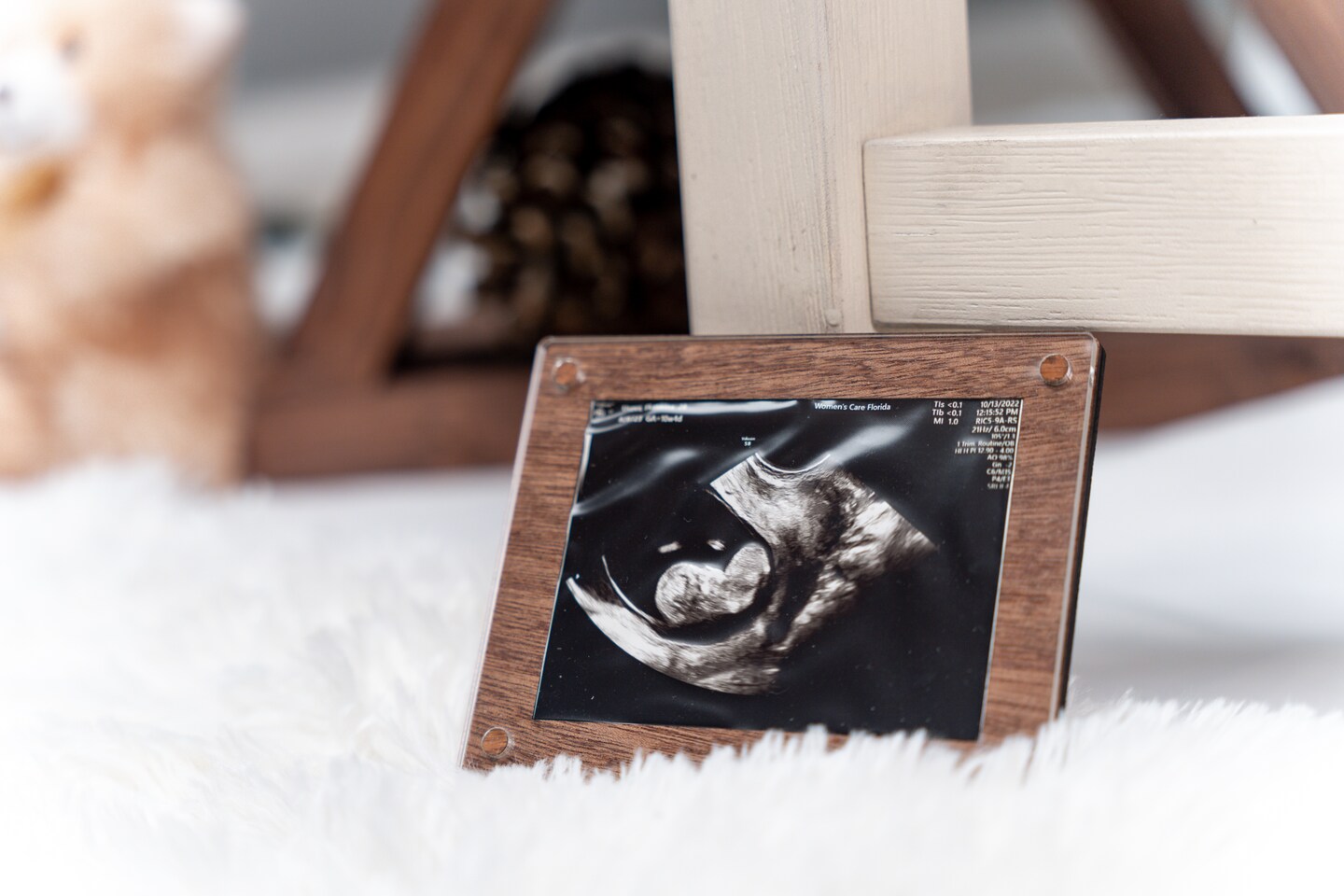  Ultrasound Photo Frame