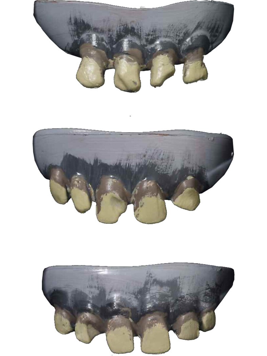 Set of 3 Grey Zombie Halloween Costume Rotted Teeth