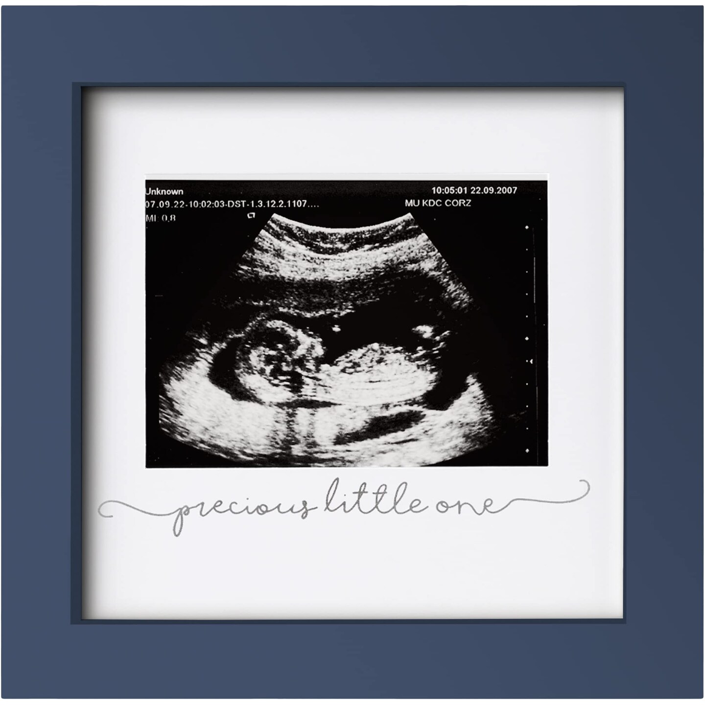 Baby Sonogram Picture Frame - Modern Ultrasound Frame For Mom To Be - Pregnancy Announcement Sonogram Photo Frames - Gender Reveal For Expecting Parents - First Time Dad Gifts (Midnight Blue)