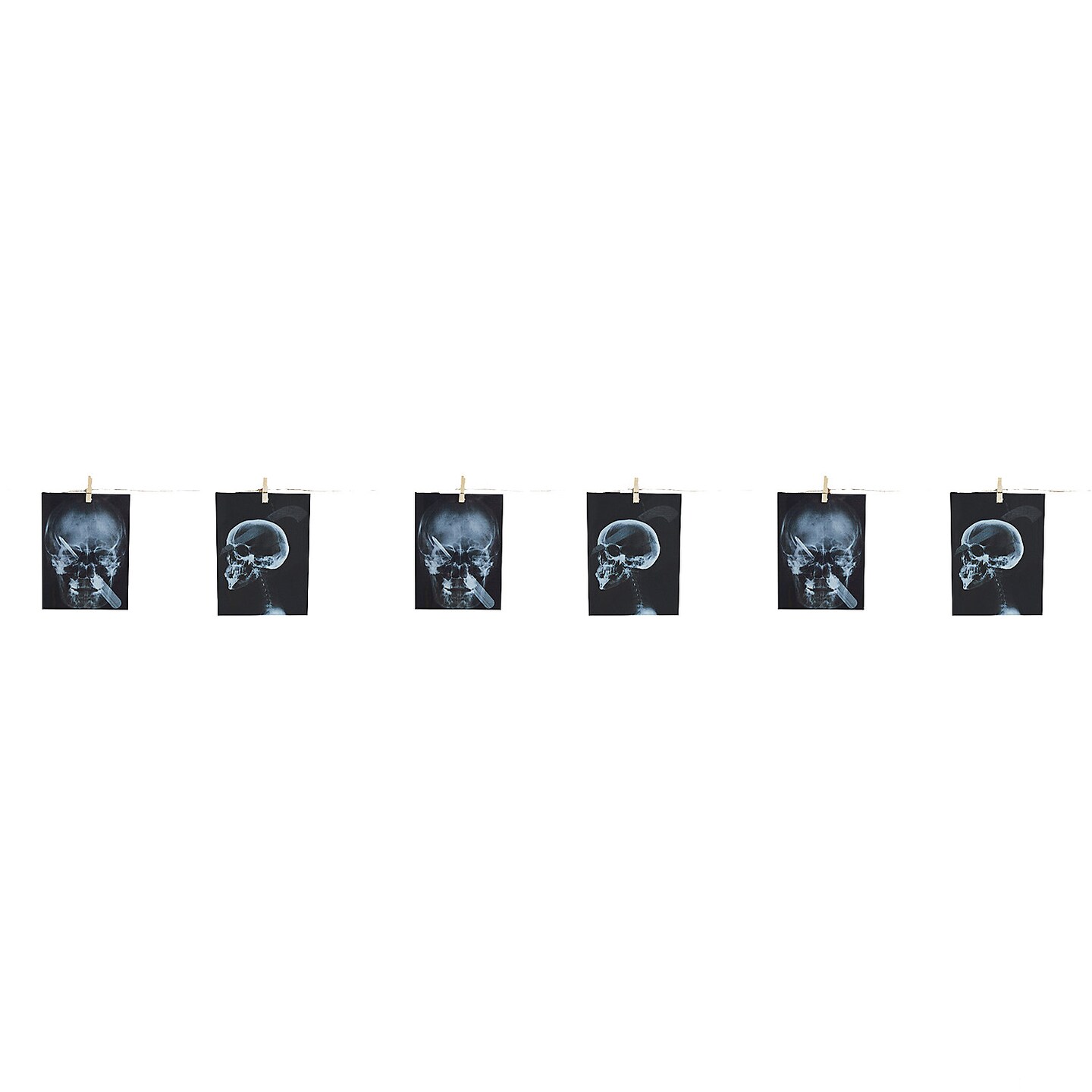 Garland Torture X-Ray 63 In