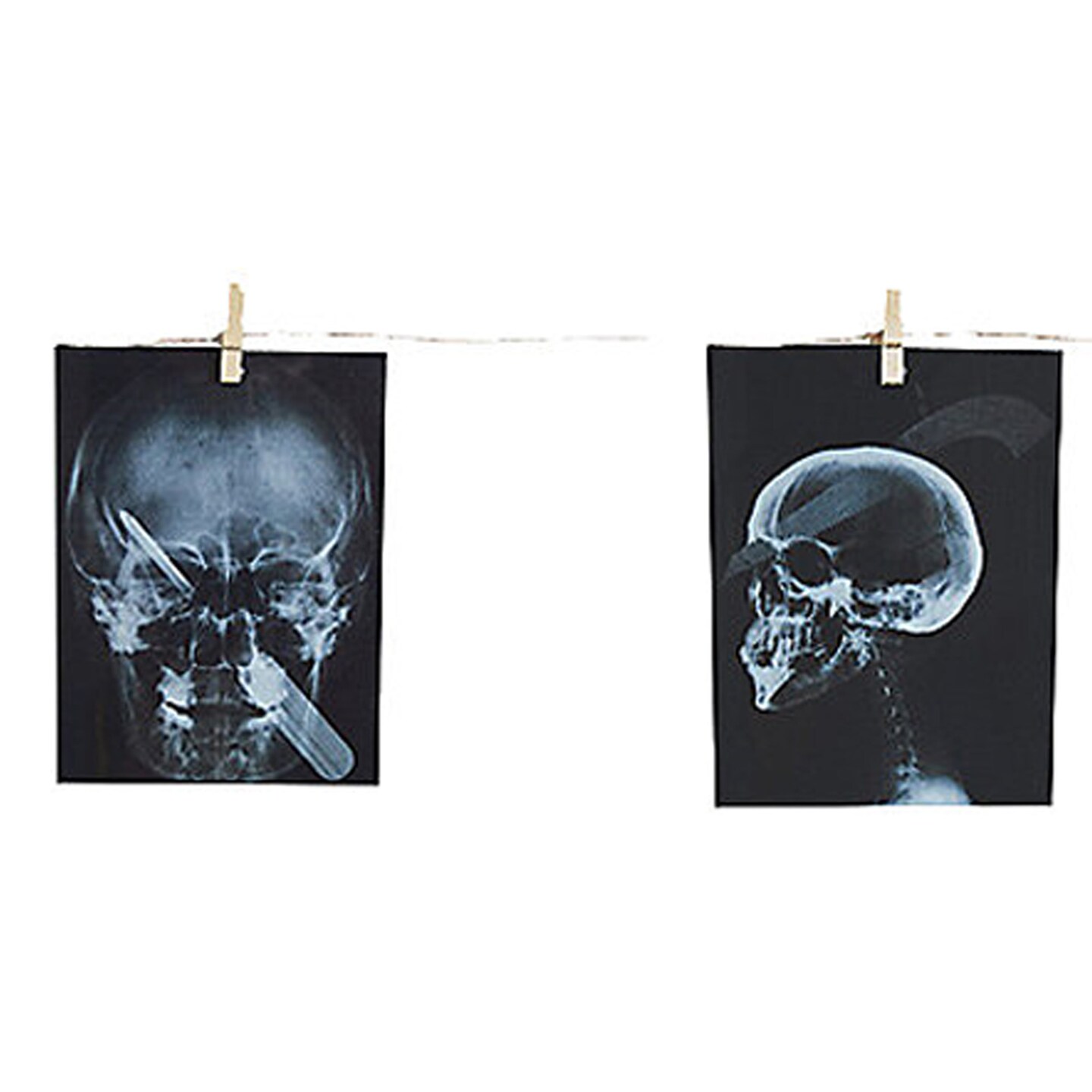 Garland Torture X-Ray 63 In