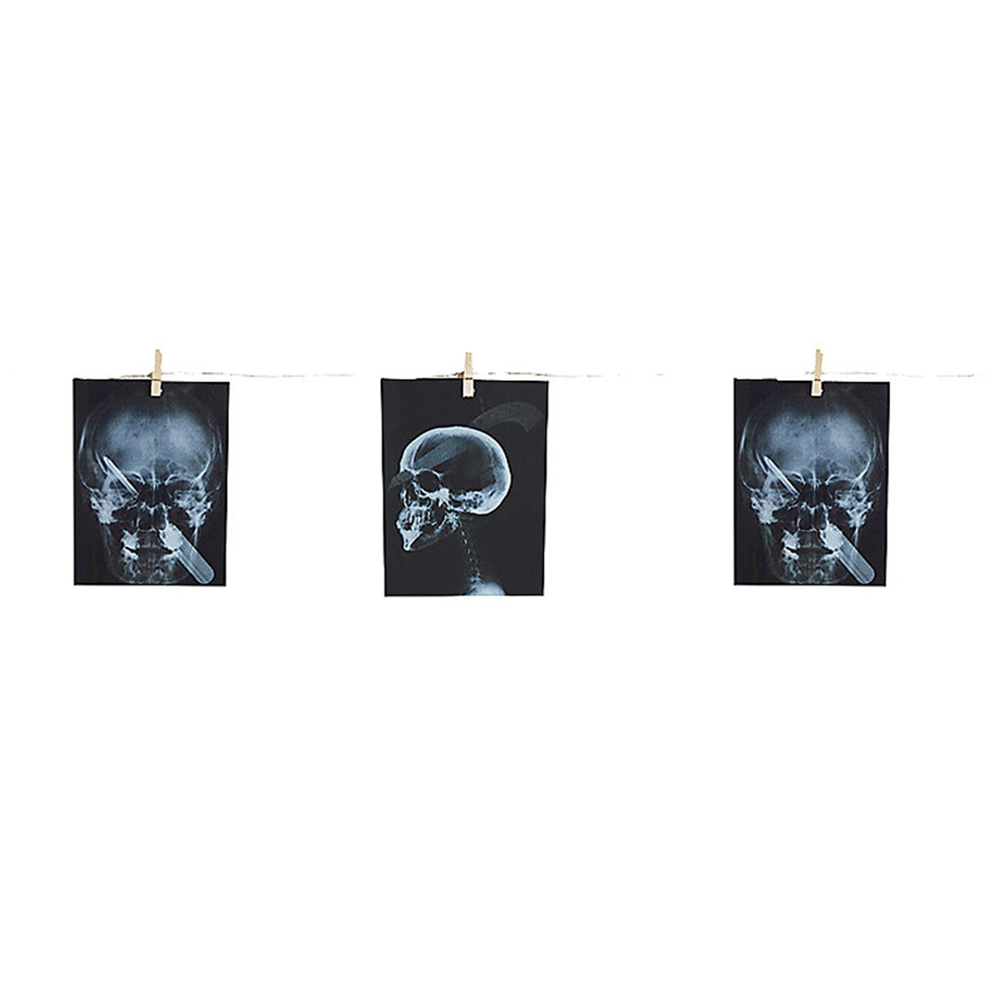 Garland Torture X-Ray 63 In