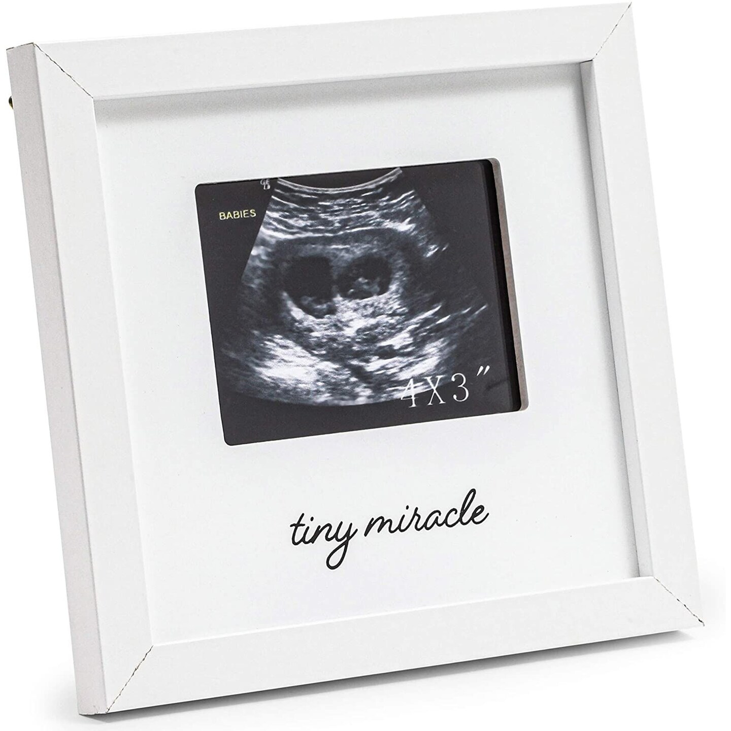 White Sonogram Keepsake Frame for 4 x 3 Ultrasound Photos (7 x 6.5 Inches)