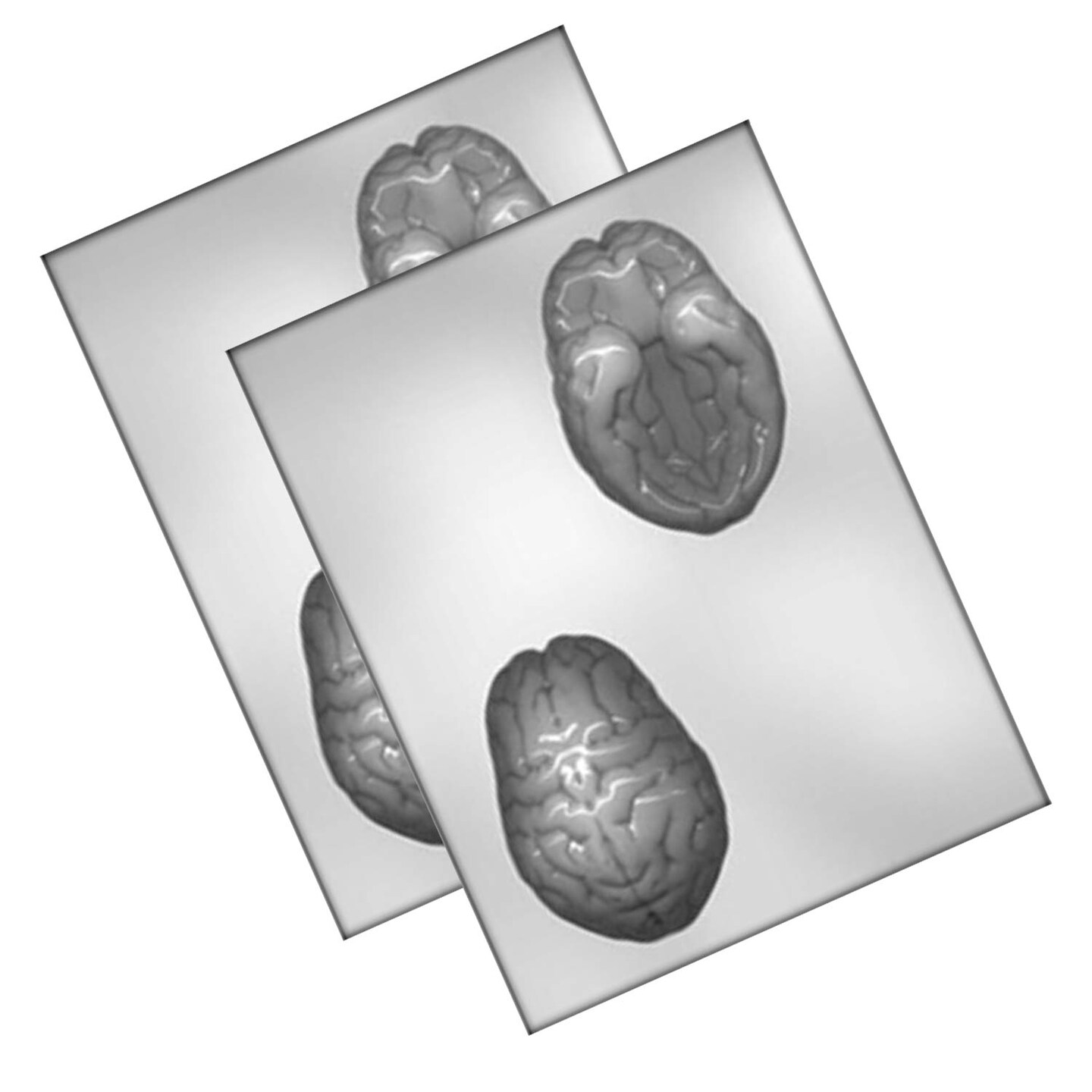 4&#x22; 3D Brain Mold