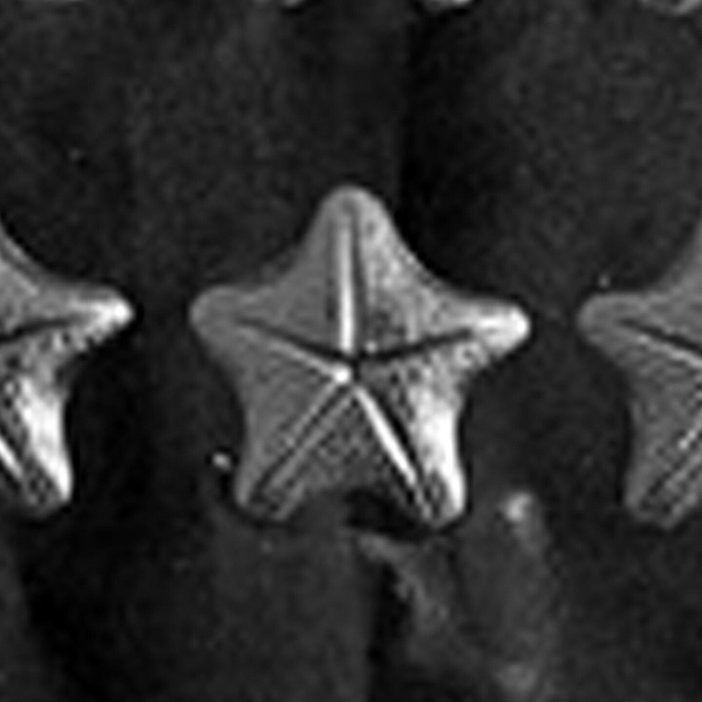 Starfish Chocolate Mold