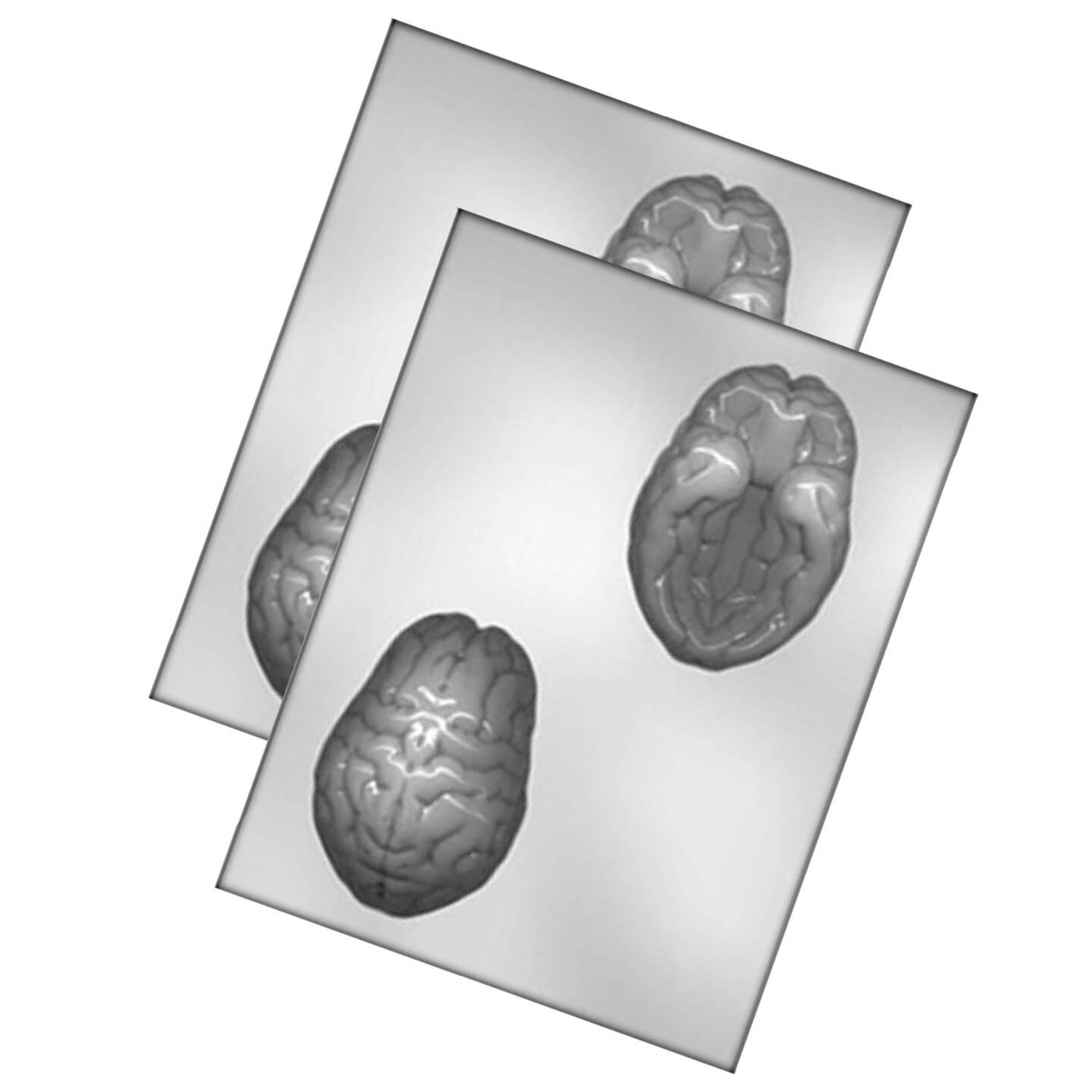 4&#x22; 3D Brain Mold