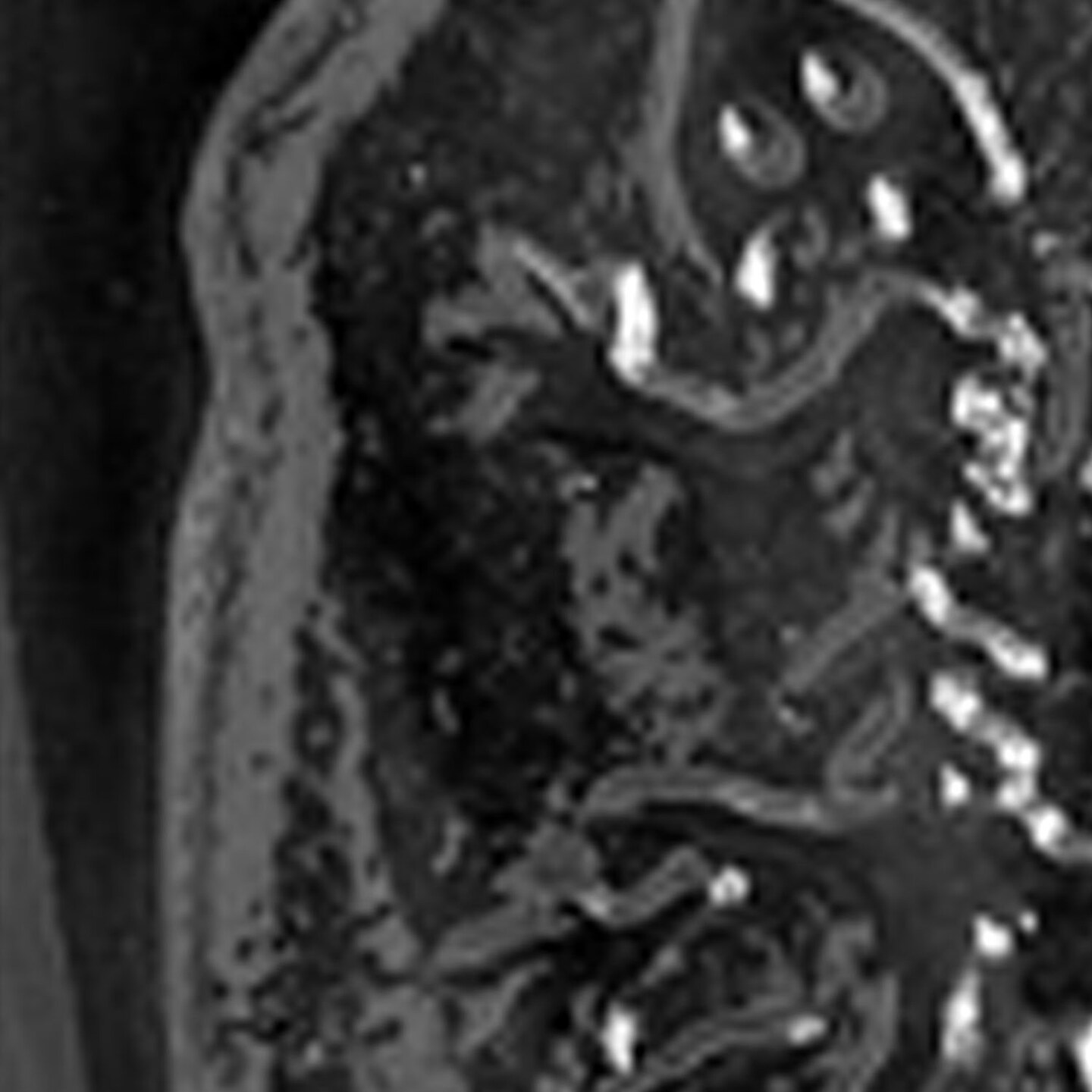 Dinosaur Fossil Chocolate Mold